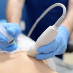 Биопсия с УЗИ при раке